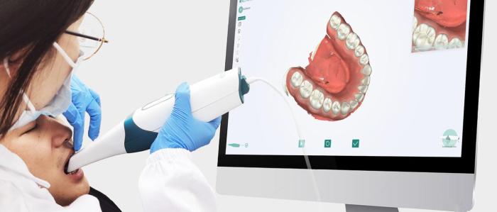 Intraoral technique of exposing dental images