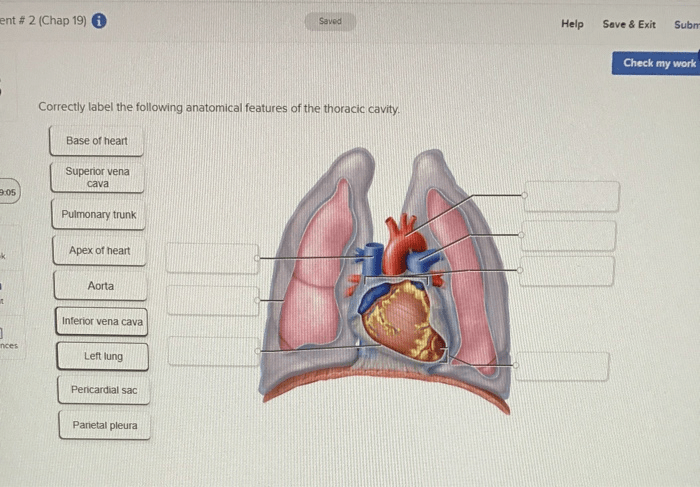 Correctly label the following lymphatics of the abdominal cavity